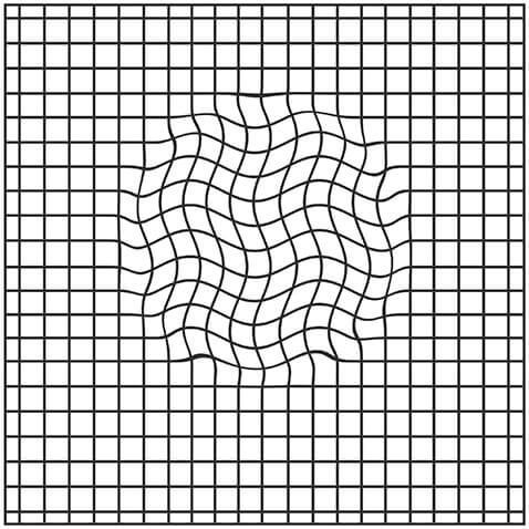Amsler Grid with Wavy Lines