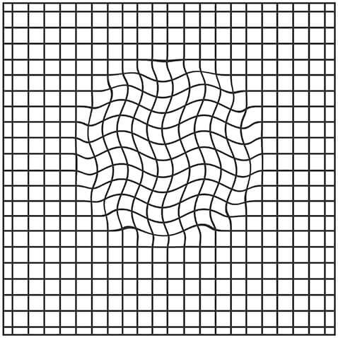 Amsler Grid with Wavy Lines