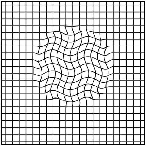 Amsler grid eye test for detecting macular problems