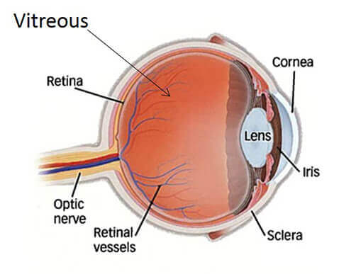 Vitreous Diagram